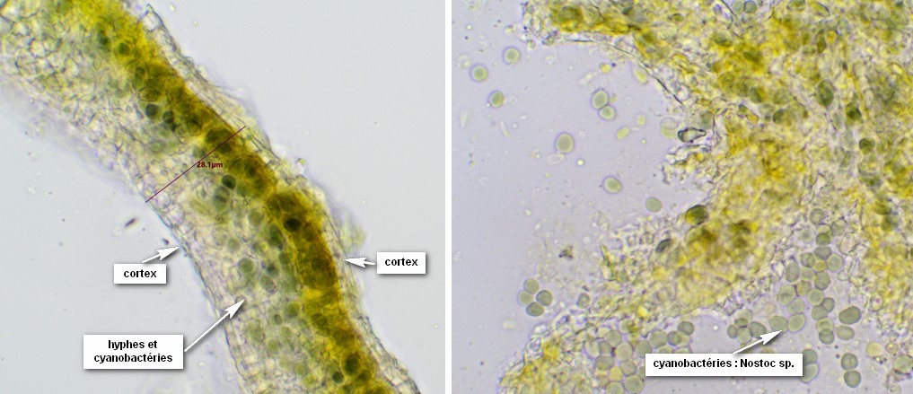 Thalle de Leptogium cyanescens : cortex et cyanobactéries (courtes chaines de Nostoc)