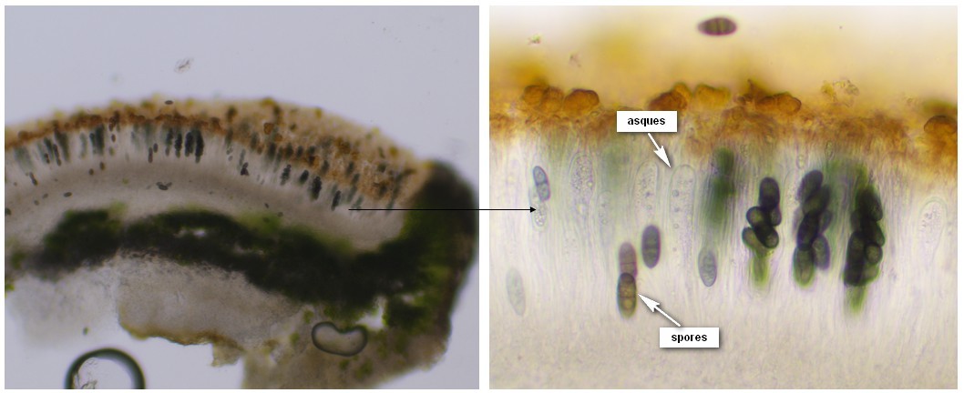 Apothécie : asques et spores de Physcia aipolia